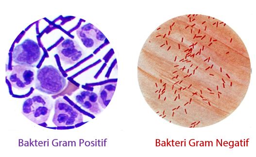 Detail 10 Contoh Bakteri Gram Positif Nomer 10