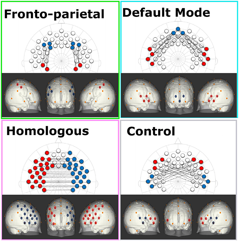 Detail 133 Brain Dots Nomer 45