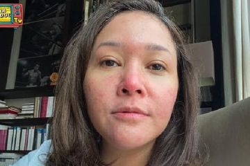 Detail Bedak Untuk Rosacea Nomer 9