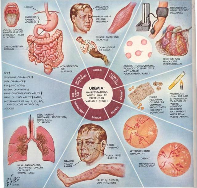 Detail Buku Diet Penderita Ginjal Nomer 20