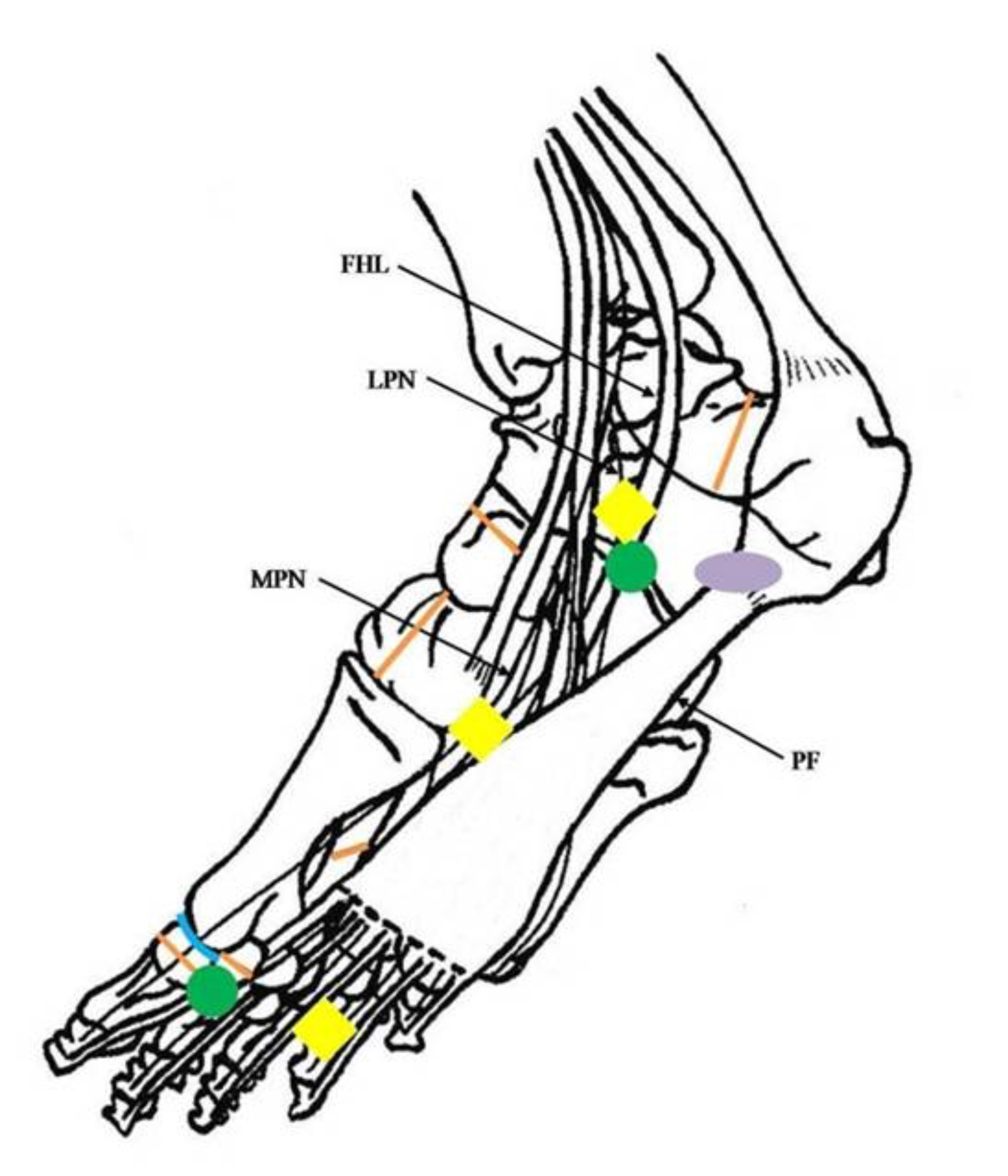 Detail Musculus Flexor Hallucis Brevis Nomer 6