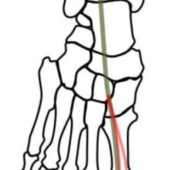 Detail Musculus Flexor Hallucis Brevis Nomer 4