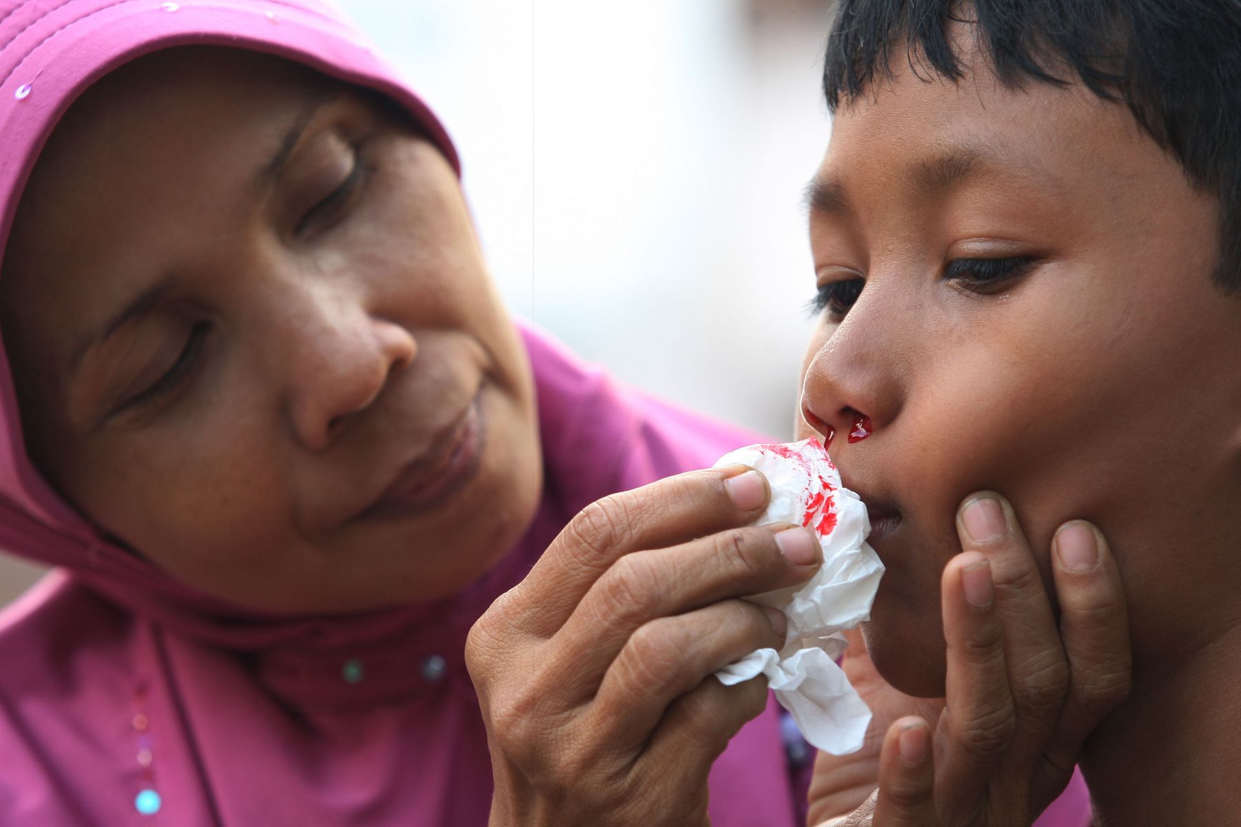 Detail Cara Mengatasi Anak Mimisan Nomer 18