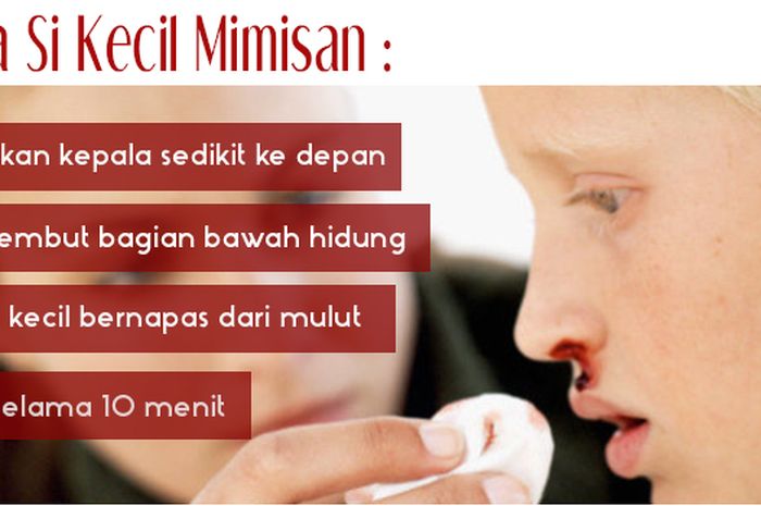 Detail Cara Mengatasi Anak Mimisan Nomer 27