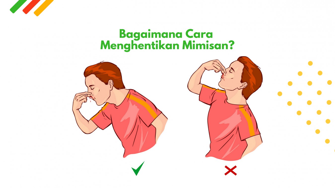 Detail Cara Mengatasi Anak Mimisan Nomer 9