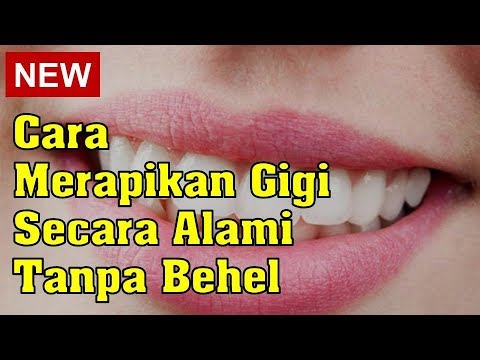 Detail Cara Senyum Gigi Tonggos Nomer 47