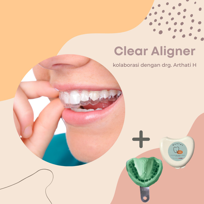 Clear Aligner Harga - KibrisPDR