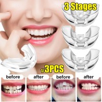 Detail Clear Aligner Harga Nomer 13