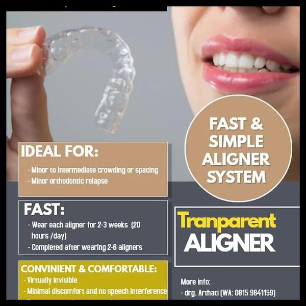 Detail Clear Aligner Harga Nomer 45