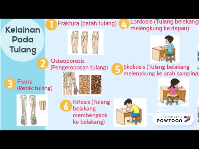 Detail Contoh Brosur Kesehatan Organ Gerak Manusia Nomer 7