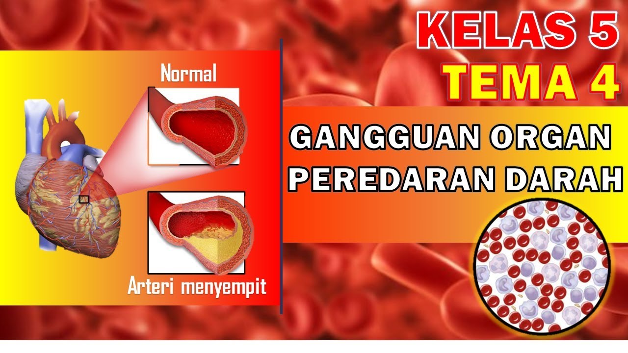 Detail Contoh Penyakit Yang Bisa Mengganggu Organ Peredaran Darah Manusia Nomer 29