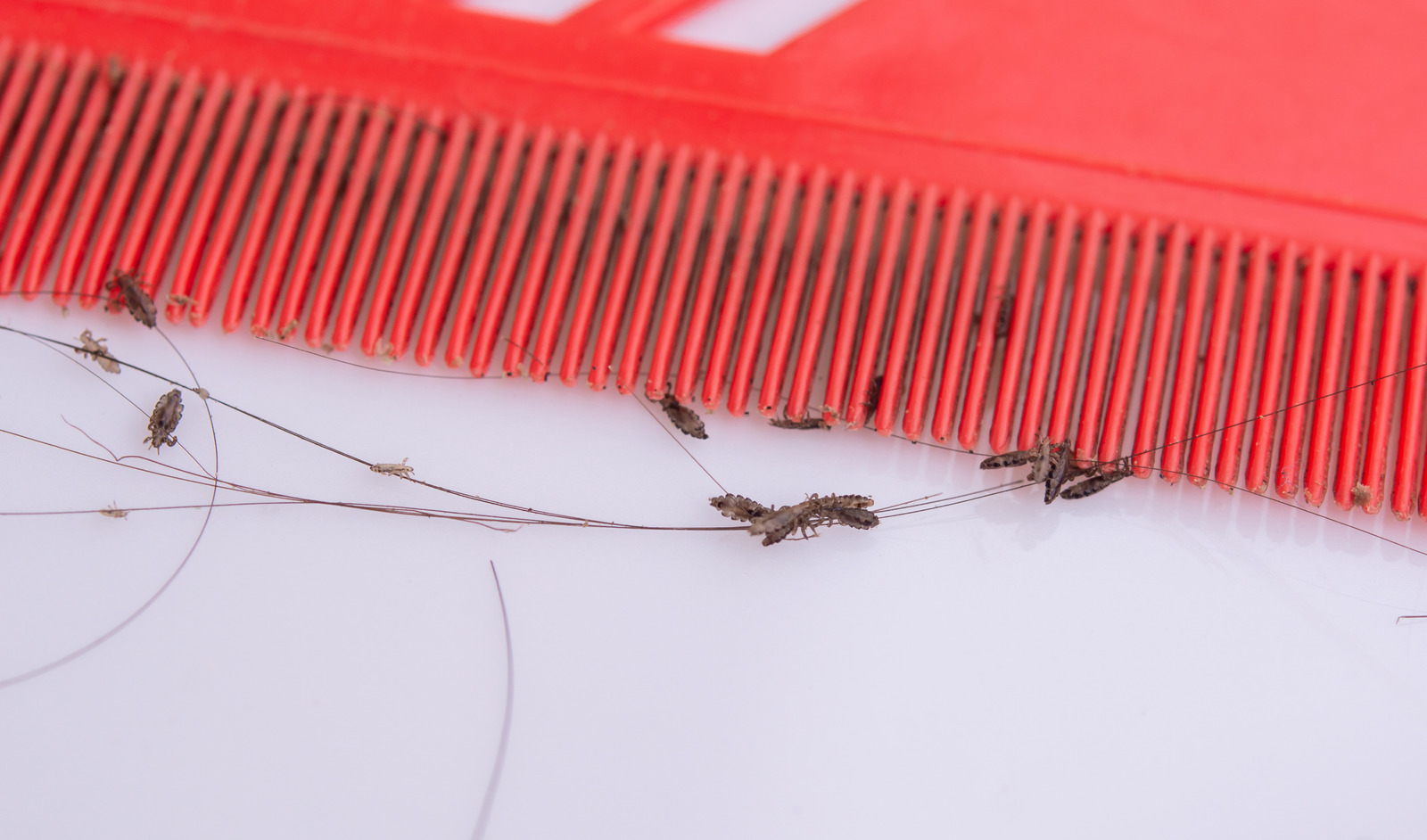 Detail Foto Kutu Rambut Manusia Nomer 29