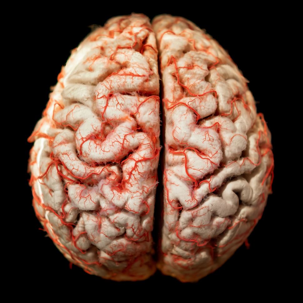 Detail Foto Otak Manusia Nomer 22