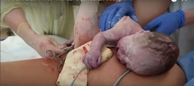 Detail Foto Proses Melahirkan Bayi Secara Normal Nomer 52