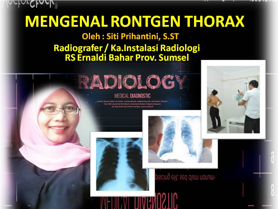 Detail Foto Thorax Adalah Nomer 14