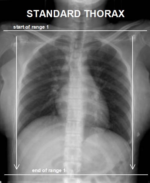 Detail Foto Thorax Adalah Nomer 21