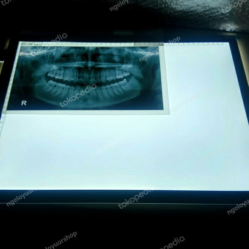 Detail Foto Thorax Adalah Nomer 39