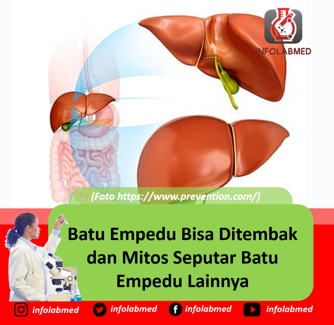 Detail Gambar Batu Empedu Manusia Nomer 26