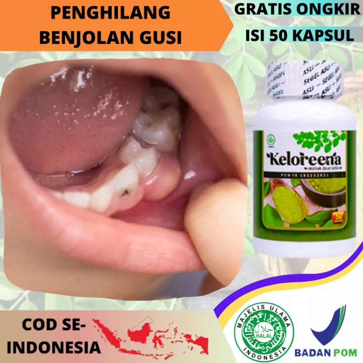 Detail Gambar Bayi Merapatkan Bibir Bawah Dan Atas Nomer 45