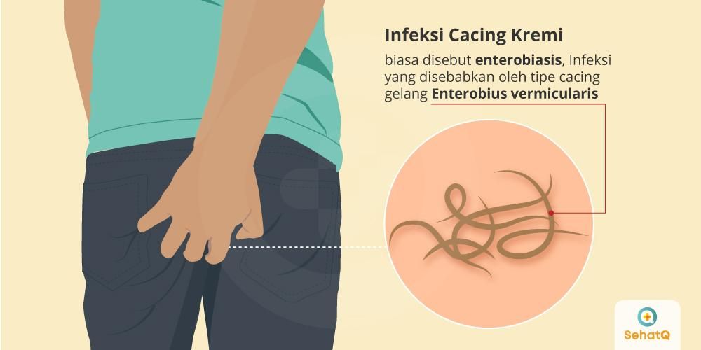 Detail Gambar Cacing Dalam Perut Manusia Nomer 16