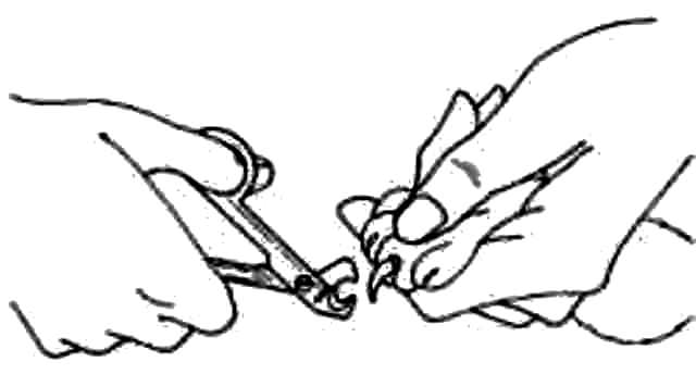Detail Gambar Cacing Perut Pada Anak Potong Kuku Kartun Nomer 17