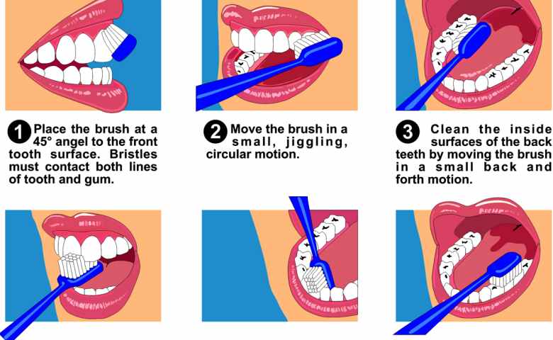Gambar Cara Menggosok Gigi Yang Benar - KibrisPDR