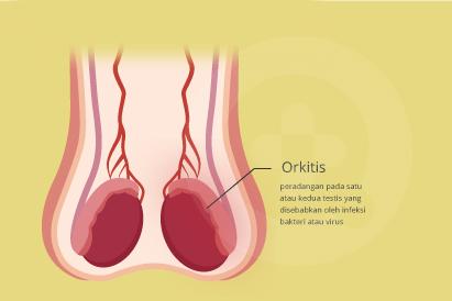 Detail Gambar Dan Penjelasan Orkitis Nomer 12