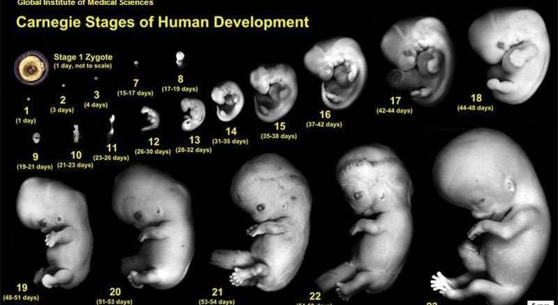 Gambar Embrio Manusia - KibrisPDR