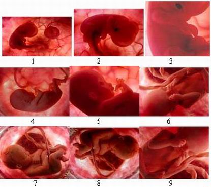 Detail Gambar Embrio Manusia Nomer 9