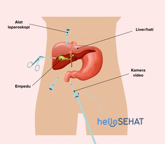 Detail Gambar Empedu Manusia Nomer 13