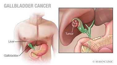 Detail Gambar Empedu Manusia Nomer 14