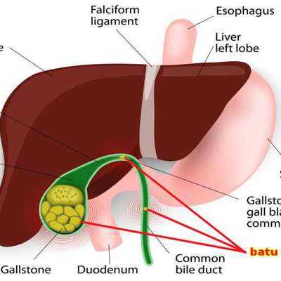 Detail Gambar Empedu Manusia Nomer 21