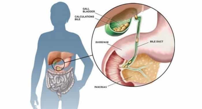 Detail Gambar Empedu Pada Manusia Nomer 5