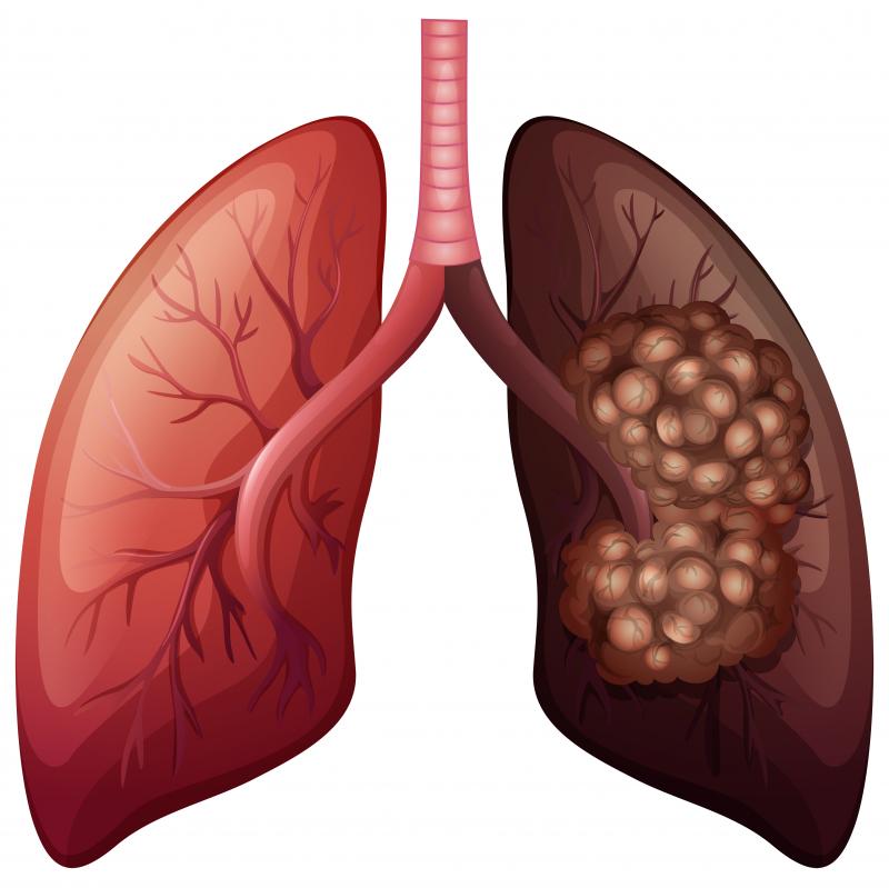 Detail Gambar Hati Gambar Rongga Pernapasan Manusia Nomer 24