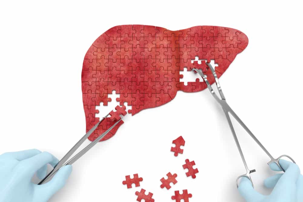 Detail Gambar Hati Organ Manusia Nomer 36