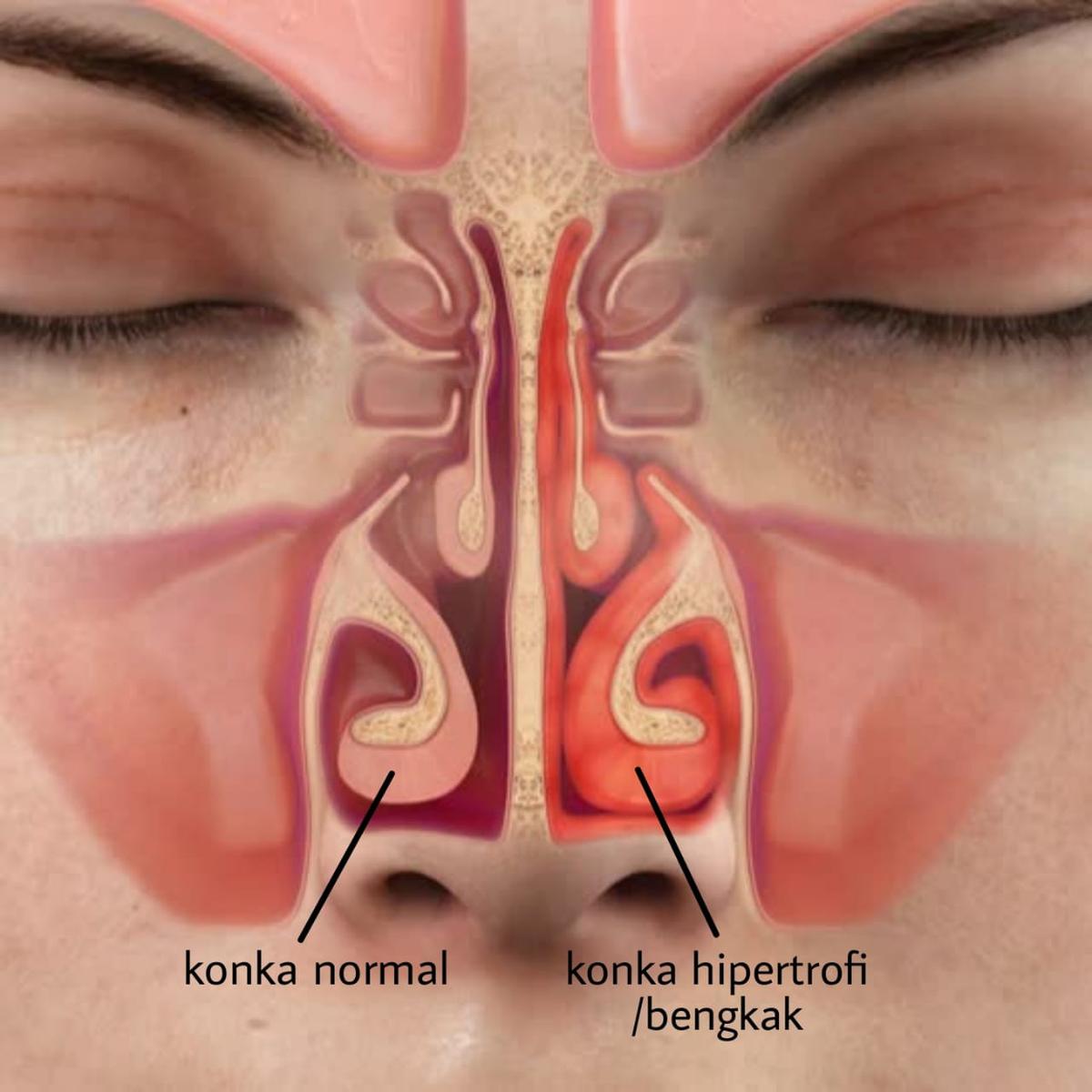 Detail Gambar Hidung Manusia Nomer 15