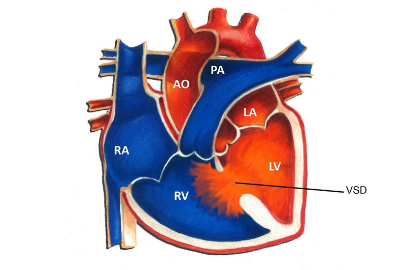 Detail Gambar Jantung Beserta Bagiannya Nomer 28