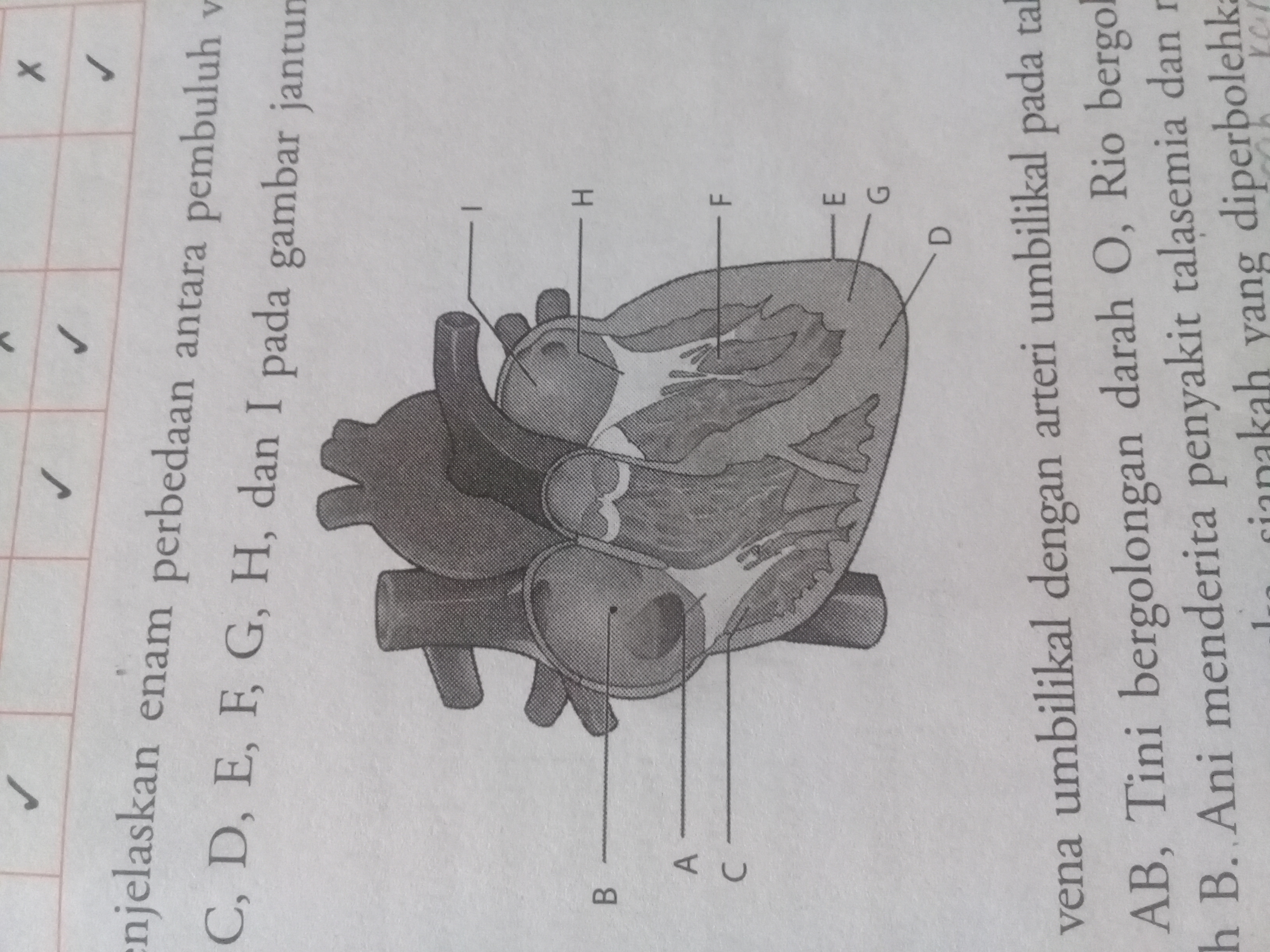 Detail Gambar Jantung Beserta Organ Organnya Nomer 18