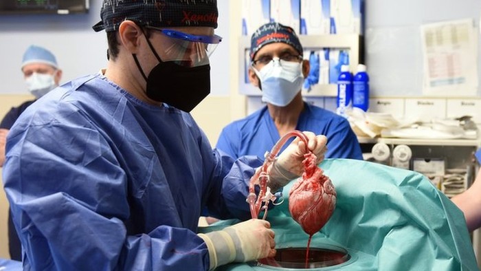 Detail Gambar Jantung Beserta Organ Organnya Nomer 35