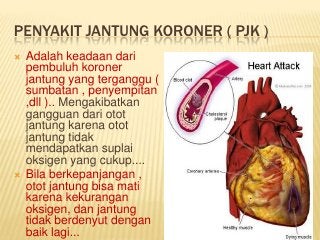 Detail Gambar Jantung Gambar Jantung Bahasa Indonesia Nomer 13