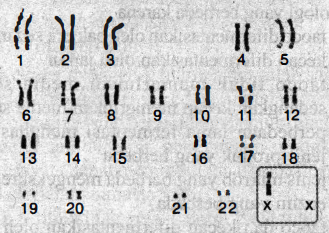 Detail Gambar Kariotipe Manusia Nomer 2