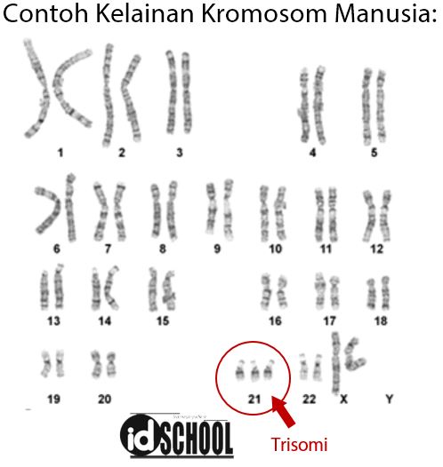 Detail Gambar Kariotipe Manusia Nomer 15