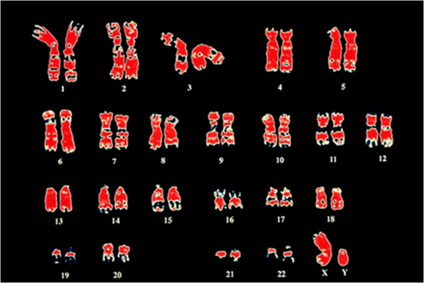 Detail Gambar Kariotipe Manusia Nomer 28