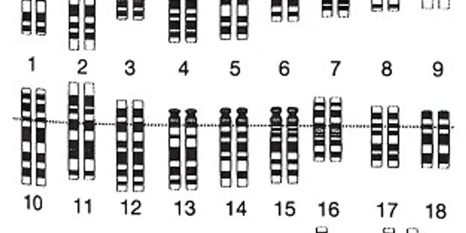 Detail Gambar Kariotipe Manusia Nomer 40