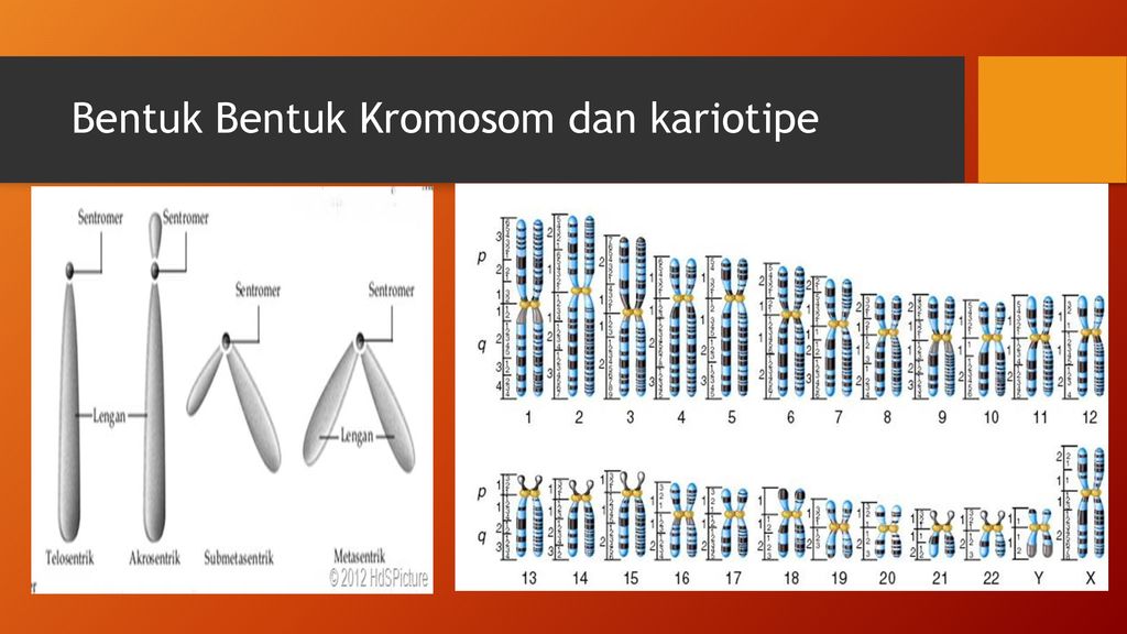 Detail Gambar Kariotipe Sel Sperma Nomer 18