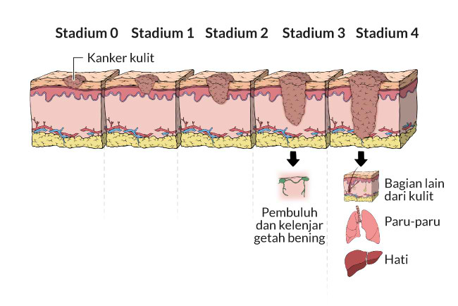 Detail Gambar Kulit Beserta Keterangannya Nomer 38