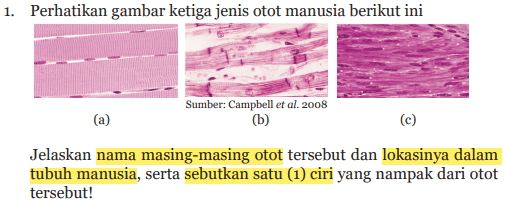 Detail Gambar Macam Macam Otot Manusia Nomer 49