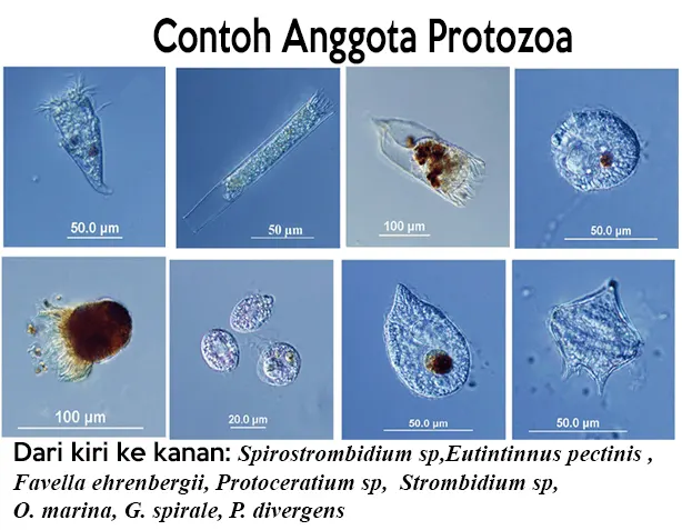 Detail Gambar Macam Protozoa Nomer 17