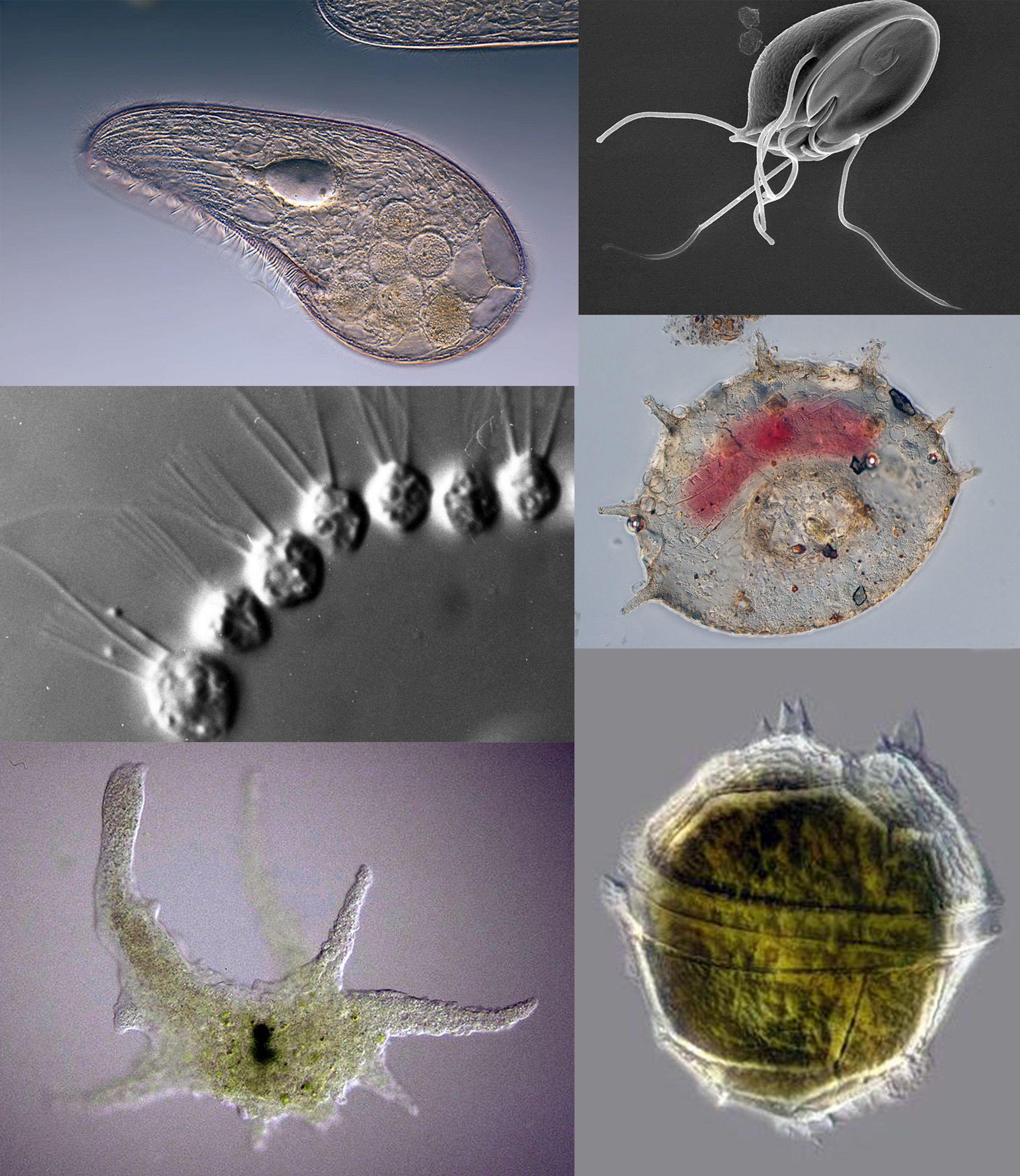 Detail Gambar Macam Protozoa Nomer 8