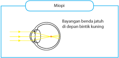 Detail Gambar Mata Beserta Bagiannya Nomer 33